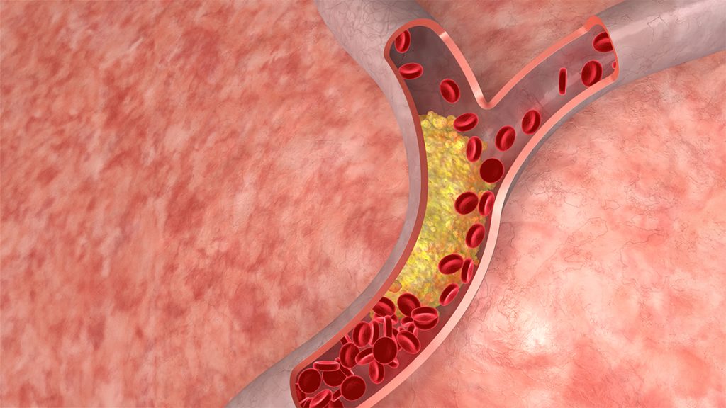 Myths of Good and Bad cholesterol: What is Cholesterol?