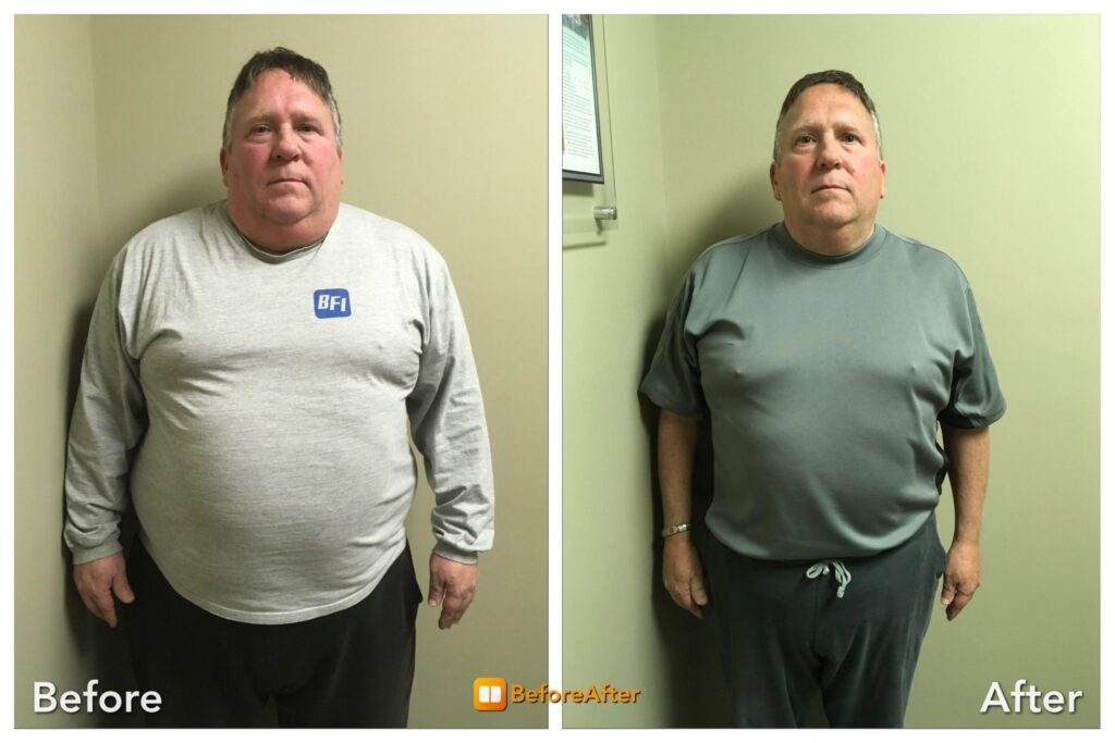 Ozempic and Weight Loss: Can Medication Replace Healthy Eating?